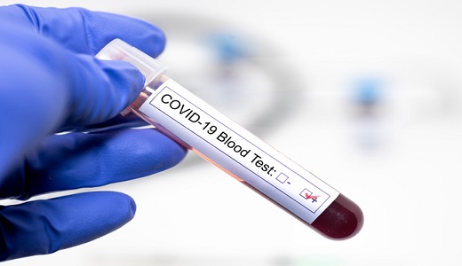 Blood sample labelled as COVID-19 positive